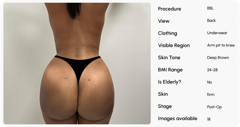 Staff spends hours creating before/afters in Canva