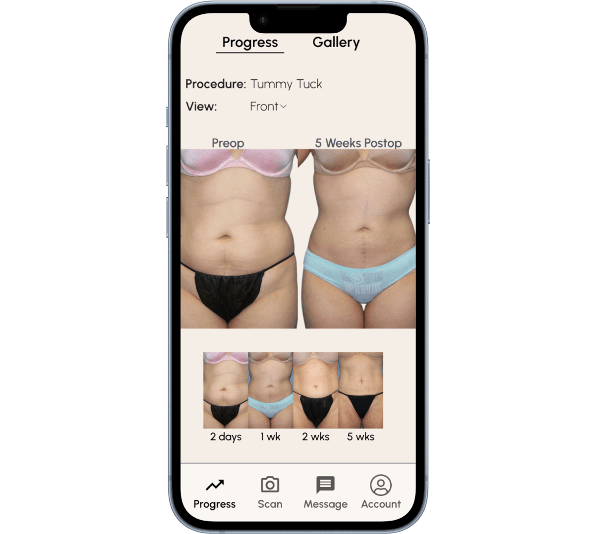 Evolution MD using ClinicOS lead widget