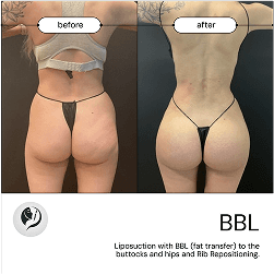Before and after result 1