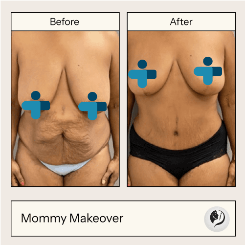 Before and after result 2