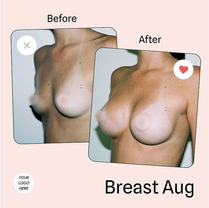 Tummy tuck vs liposuction comparison