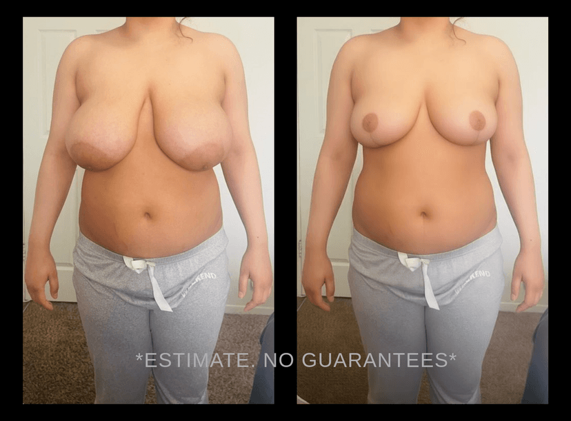 AI Plastic Surgery Simulation: How It Works and Why Surgeons Use It